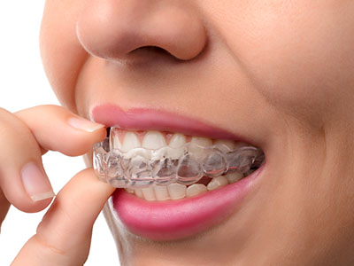 The image shows a person with a mouth full of teeth, holding a toothbrush near their lips, ready to brush.
